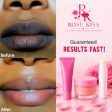 Rose Kiss - Le Kit Complet Pour Avoir Les Lèvres Roses