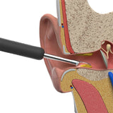 Nettoyeur Oreille Pro